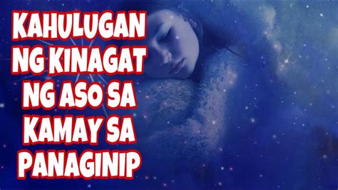 kinantot ang aso|Bata, kinagat ng 20 aso .